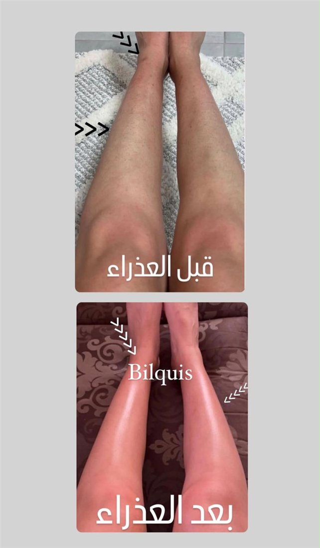 نتيجة قبل وبعد للجسم – بلقيس