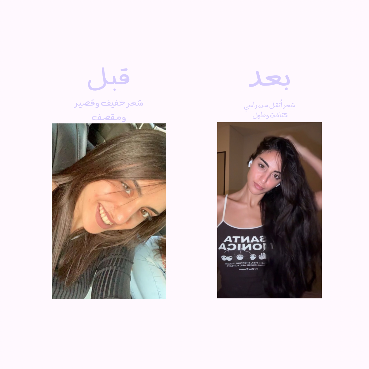 الرزمة العلاجية للشعر - توصيل مجاني