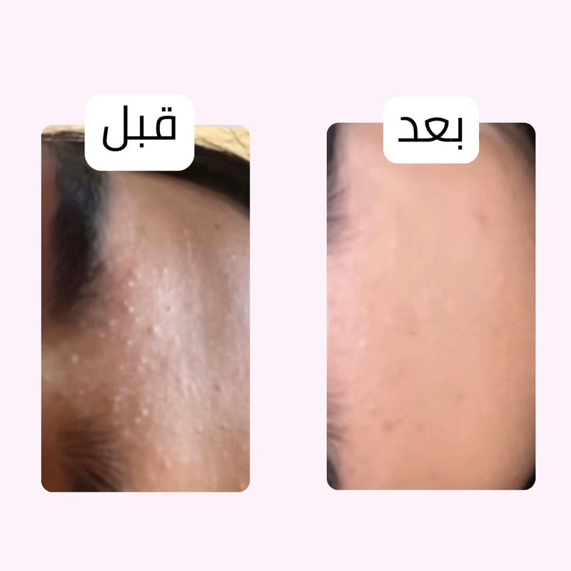 قبل وبعد