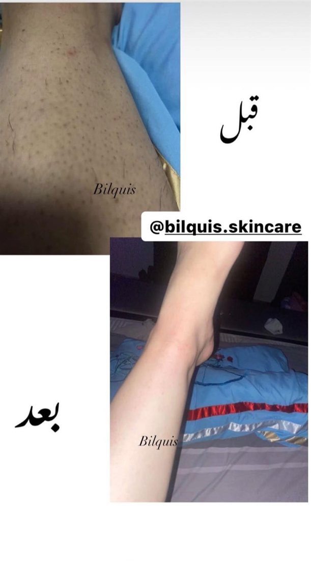 نتيجة حقيقية من زبونة