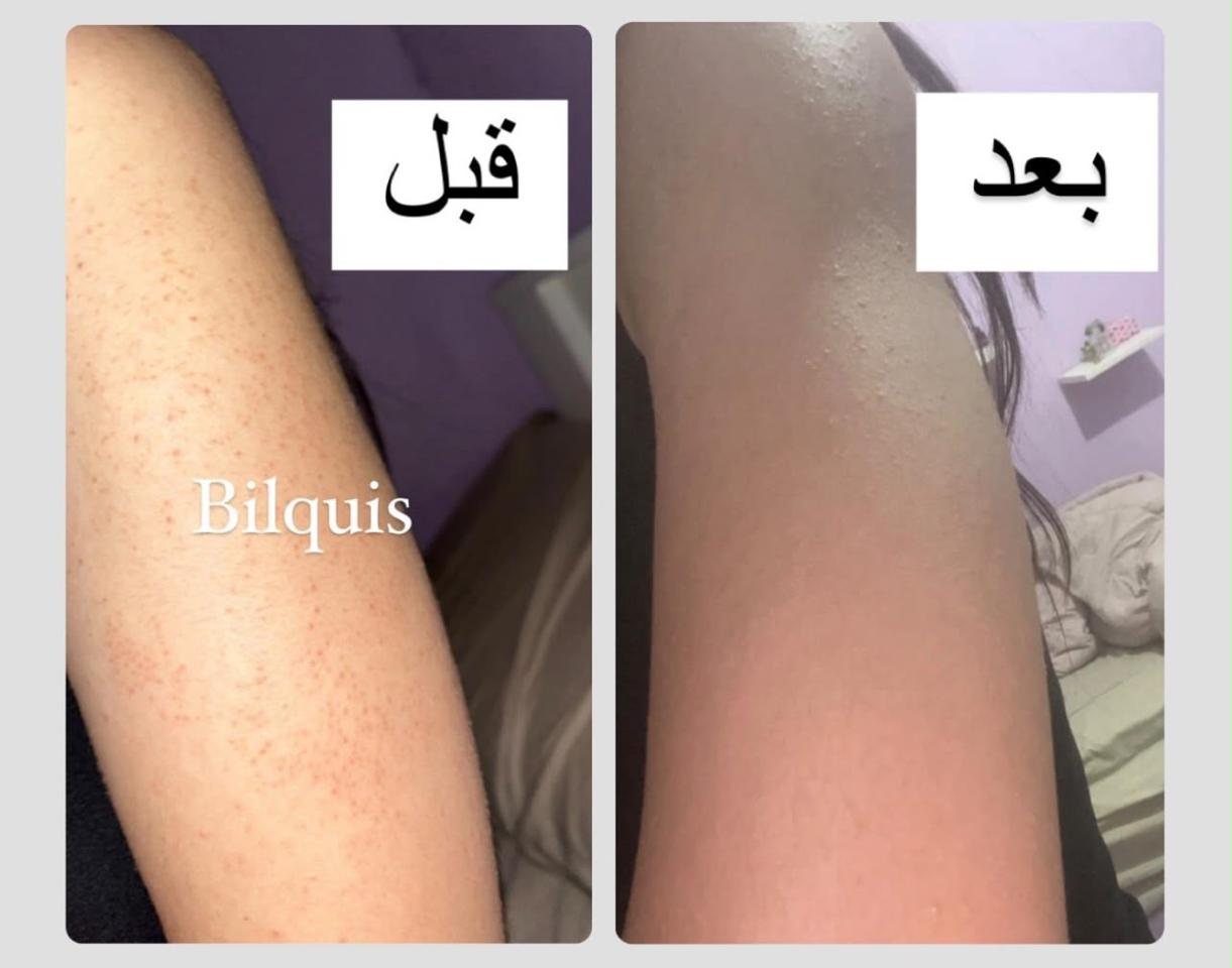 نتيجة حقيقية من زبونة
