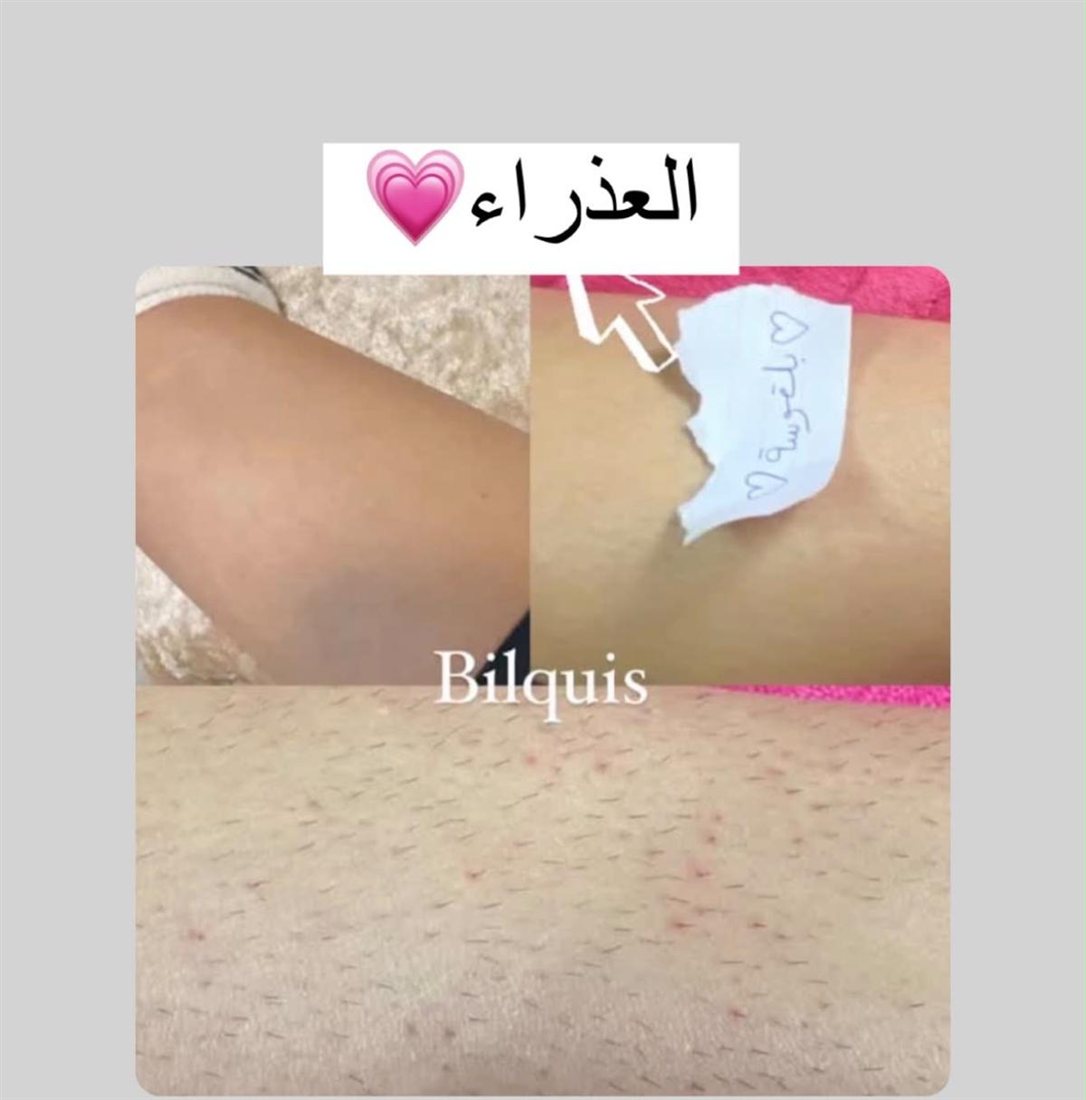 نتيجة حقيقية من زبونة